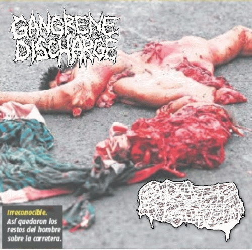 Gangrene Discharge : Gangrene Discharge - Cadaver Pouch Conveyor